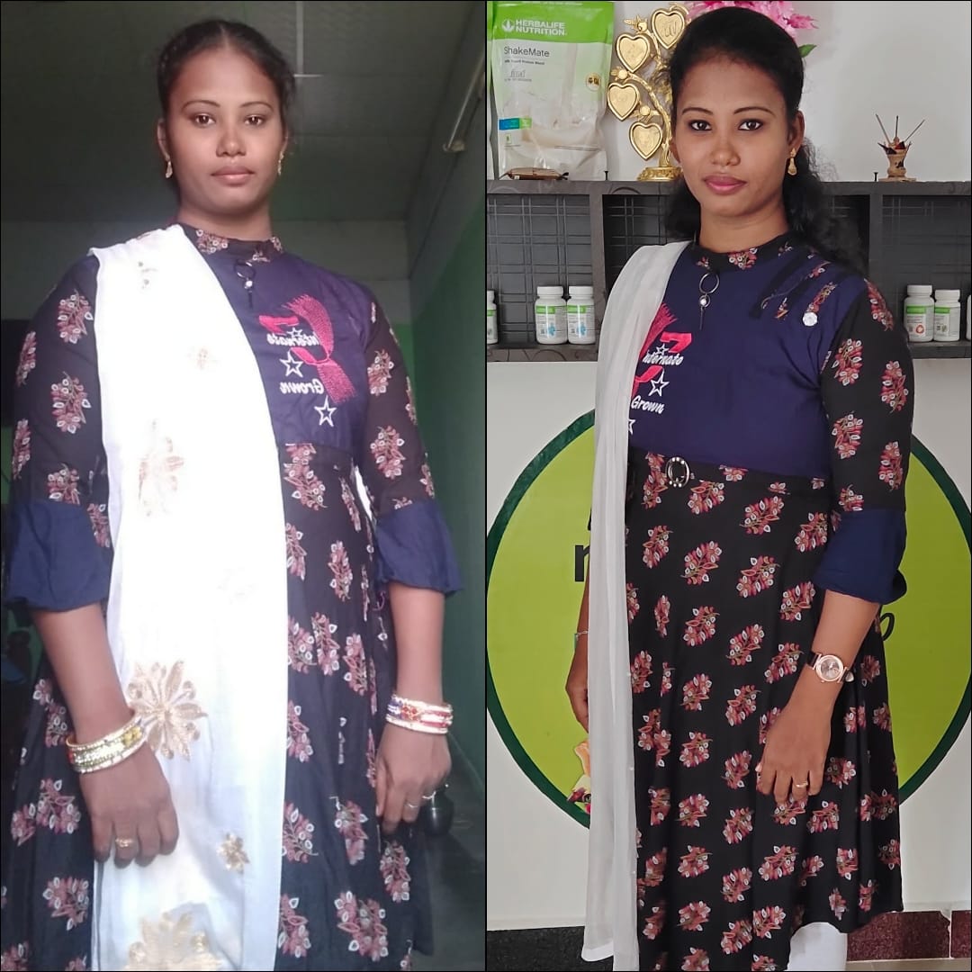 weight loss