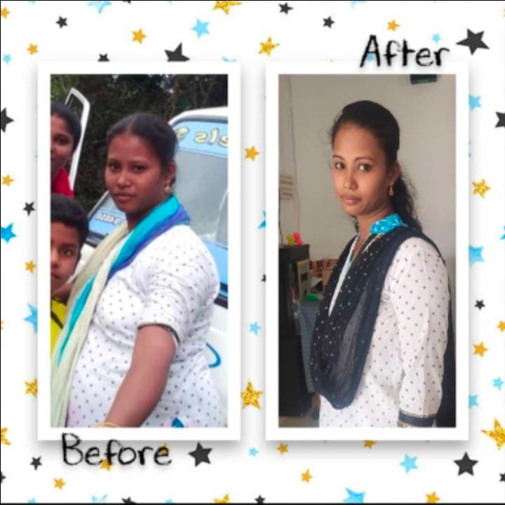 weight loss